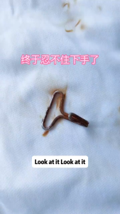 MLADEN Clothing To Rust Stains To Rust Wate Clothing Rust Removal Rust Removal Water Embroidery Clothing Cleansing Rust Remove