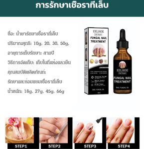 【กำจัดเชื้อราที่เล็บ】น้ำยารักษาโรคเชื้อราที่เล็บ Fungal Nail Treatment EELHOE 指甲修护液 30ml/50ml Nail Repair Liquid Nutritional Care Liquid Nail Shine Nails Dead Skin Repair Thickening Moisturizing