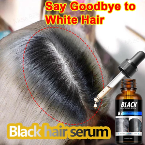 Black Hair Serum White Hair Turns Black Serum 30ml Blackening of Hair Roots Herbal Hair Care Naturally Eliminate Gray Hair Hair Growth Serum Treatment Hair Loss Promotes Hair Thicker Stronger