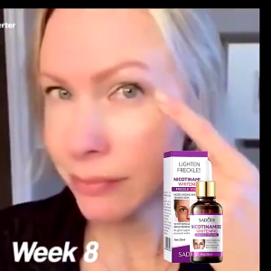 [ BUY 1 TAKE 2 ] SADOER Niacinamide Whitening Hyaluronic Acid Serum Remove Freckle VC Serum