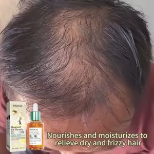 EELHOE Hair Regrowth Serum Prevent Hairs Loss Improve Hair Thinning Repair Damage Scalp 45ml