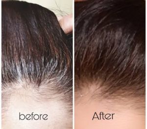 BIORGANIC HAIR GROWER GRAY OFF