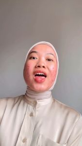 Skinmology Acne Spot: Solusi Jerawat Alami untuk Kulit Wajah