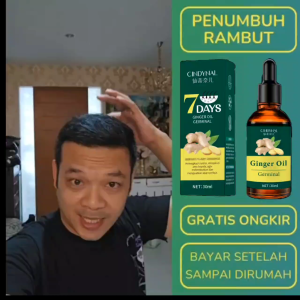 BPOM !! Cindynal Ginger Germinal Oil Minyak Penumbuh Dan Perawatan Rambut 30ml / Ginger King Serum Anti Botak Rambut Lebat Sehat Berkilau