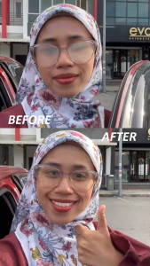 evo Anti-fog Cleaning Cloth Combo With Lens Spray Cleaner And Microfiber Cleaning Cloth For Spec Kain Cermin Mata