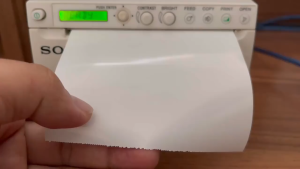 (1 roll) Ultrasound Thermal Paper Type 5 UPP-110HG High Gloss