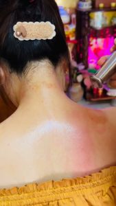 Chày Đồng Giải Cơ Hội Quán Diện Chẩn Bùi Quốc Châu