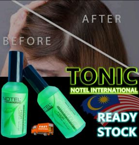 (Hair Growth Tonic) Notel Green Tea Hair Tonic