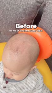 Fora Natures Shampoo Penumbuh Rambut Bayi & Anak 150ml