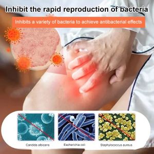 Bee Venom Skin Repair Cream Multi Solution Cream Repair Hand Foot Skin Redness Itchiness Moisturizing Smoothing Skin Bee Venom Cream Skin Care