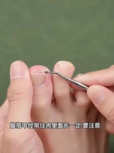 CMGF | Bộ Kềm Cắt Móng Chân với Dụng Cụ Móng Mọc Vào