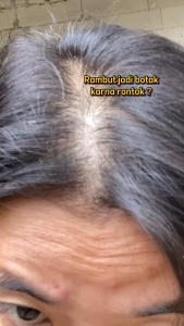 [BPOM] Kemiry Organic Minyak Kemiri Bakar Original Penumbuh Rambut Alis Asli Pria Brewok Penebal Perawatan Rontok Pelebat Jenggot Penghitam Hitam