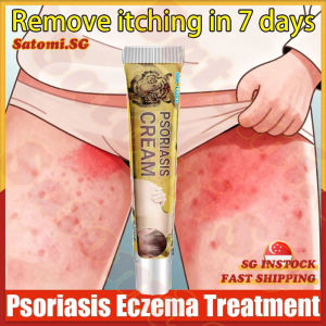 💄SG Stock💄 Herbal eczema psoriasis cream / Ringworm cream / Psoriasis ointment / Antibacterial anti itch cream / 牛皮癣 / 濕疹药膏 / 止癢膏