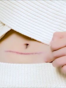 SADOER Fast Scar Removal Cream Effective Treatment Stretch Marks Burn Surgical Scars Acne Spots Repair Whitening Moisturizing Skin Care