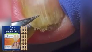 Miếng Dán Trị Nấm Móng Ximonth Cỡ Trung Bình Thoáng Khí Phục Hồi Móng Bị Đổi Màu Gãy Điều Trị Nấm Móng Chân Qua Đêm Chăm Sóc Chân