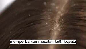 Shampo Jahe & Polygonum Multiflorum: Solusi Perawatan Rambut Rontok