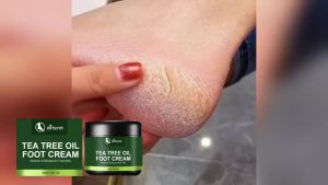 Tea Tree Oil Foot Cream for Heel Dry Skin Care Exfoliate Dead Skin Soften Hydrate Moisturize Smooth Rough Skin Foot Care Lotion