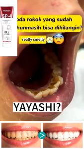 【Fresh jasmine flavor】 YAYASHI SP-4 probiotic whitening toothpaste whitens stains Sp-4 probiotic toothpaste fresh breath teeth whitening toothpaste 120g