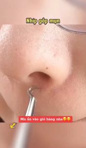 Nhíp gắp mun cám mụn đầu đen sợi bã nhờn dạng đầu cong chất liệu thép không gỉ