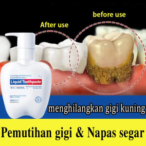 Penghilang Karang Gigi/Pasta gigi pemutih- Atasi Karang Gigi - Nafas yg Segar - Anti Bau Mulut - Menghilang Bakteri dalam Mulut - pencegah gigi berlubang-Hilangkan Karang Gigi Kuning - Bebas Karang Gigi Permanen - Memutih Gigi
