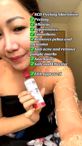 BUY1 TAKE 2 SCD 100ml Peeling Lotion | Full Body Exfoliating for Dark Spots & Stretch Marks