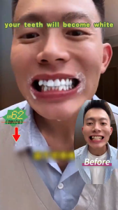 SP-4 Teeth Whitening Toothpaste Probiotic Toothpaste Removes Plaque Stains and Bad Odors Whitening Teeth Tartar Remover 120g