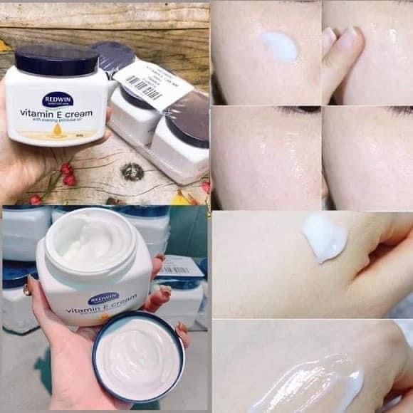 Kem%20D%C6%B0%E1%BB%A1ng%20&%20Body%20Lotion%20L%C3%A0m%20Da%20M%E1%BB%81m%20M%E1%BB%8Bn%20Redwin%20Vitamin%20E%20300gr%20c%E1%BB%A7a%20%C3%9Ac%20-%20Image%202