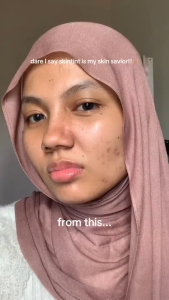 BNB Barenbliss Bloomdew Inner Light Serum Tint Skin Tint Glowy Dewy SPF50 PA++++ 24H (UNGU)