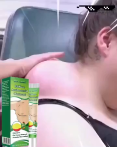 20g Lipoma Removal Cream a lipoma cream with a natural plant extract formula deeply penetrates and effectively treats tumors and skin swelling. Personal care.