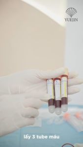 Kit PRP Matrix - Bộ Kit tách huyết tương giàu tiểu cầu 18 món - Yuejin (Có sẵn chất hoạt hóa)