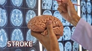 NASTRO Obat Herbal Alami Stroke Ringan & Berat Herbal Jantung Paling Ampuh