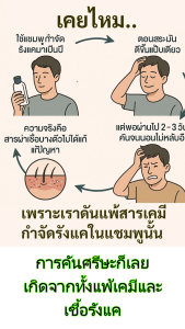 ทำแชมพูกำจัดรังแคแค่เขย่าขั้นตอนเดียว แบ่งใช้ได้ทั้งบ้าน