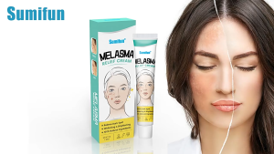 Sumifun Melasma Relief Cream - Relieve Dark Spot - Whitening & Brightening - 100% Natural Ingredients - 30ml