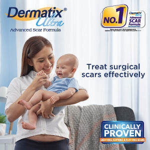 Dermatix Ultra Scar Gel 15g Reduce Deep Scars & Post-surgery Scars