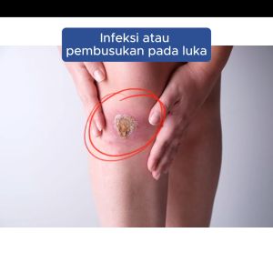 Obat Luka Pasca Operasi Luka Diabetes Pengering Luka Paling Ampuh Channamax Bharata - Vulnus Premium Berlisensi BPOM Resmi Best Seller