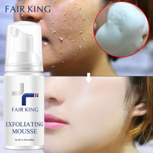 FAIR KING Facial Exfoliating Mousse Peeling Gel Face Scrub Deep Remove Cleaning All Skin Types Smooth Moisturizing Skin Exfoliator Cream