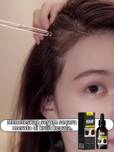 Serum penumbuh rambut obat penumbuh rambut serum rambut rontok penumbuh rambut botak 30ml serum rambut penumbuh rambut penyubur rambut penumbuh rambut botak Penebal rambut penumbuh rambut cepat Anti rontok rambut Pria dan wanita semua boleh menggunakan