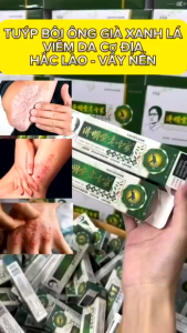 Kem nẻ ông già khô Da Chống Nứt Nẻ Á Sừng Bong Tróc Khô Da Cực Hiệu Quả