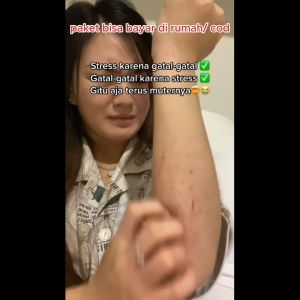 CABIYES Sabun untuk mengatasi gatal Scabies kudis Eksim Kurap Panu Biduran Tinea Cruris