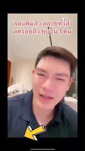 เจลแต้มสิว MEDITA ANTI-ACNE & ไวท์เทนนิ่ง คาล์มมิ่ง มอยส์เจอร์ เจล ขนาด 10 กรัม