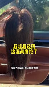 9x13cm 100% Human Hair Piece Black And Mocha Brown Hair Topper Hair Replacement Cover White Hair Breathable And Lightweight Wig Increase Hair Volume For Women