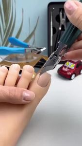 อุปกรณ์จำเป็นสำหรับการรักษาเล็บขบ กรรไกรตัดเล็บแบบเอียงป้องกันการกระเด็น สแตนเลส กรรไกรตัดเล็บหัวแหลม ทนทาน กรรไกรตัดเล็บขบ