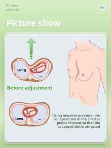 HUAIGU | Chest Indentation Corrector