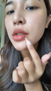 The Awesome Lips - Advanced Lips Microneedle Patch for Hydrate Plump and Fuller Lips