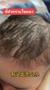 แปรงนุ่งสระผมเด็ก แปรงซิลิโคน สําหรับสระผมเด็ก และอาบน้ำ สัมผัสนุ่ม  ทำความสะอาดง่าย สระผมเด็ก