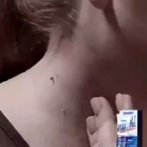 Original Wart Removal Cream Painless Wart Remover Cream Mole Remover Warts Remover Ointment Warts Magic Remover Skin Kulugo Remover Skin Tags Remover Wart Removal Serum Painless Wart Removal No scars No Skin Damage Skin Facial Care Ointment 20g