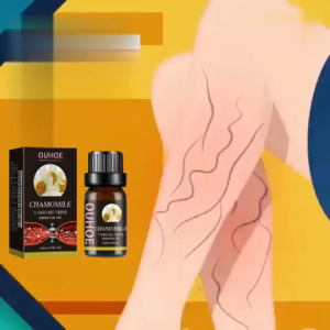 OUHOE Chamomile Leg Oil: Relieves varicose veins removes spider veins improves blood circulation soothes muscles and is a leg massage oil.