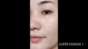 youbuy Cream Youbuy ANTI FLEK HITAM 20G Membantu Mengurangi Bintik Hitam Pada Wajah Mencerahkan