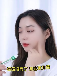 【ARK】BEOTUA Clear Face Anti Acne Moisturizing Cream 20gr Salep Obat Paling Ampuh Mengatasi Jerawat BE005