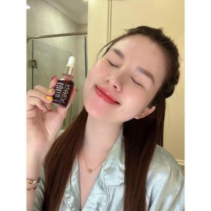 DEAL SỐC -SET 2 BỘ ĐÔI QUYỀN LỰC -KEM NÁM SIÊU ĐỈNH MELASMA TREAMENT CREAM&Red Peel Viian Tinh chất tái tạo da sinh học mờ thâm Sáng da